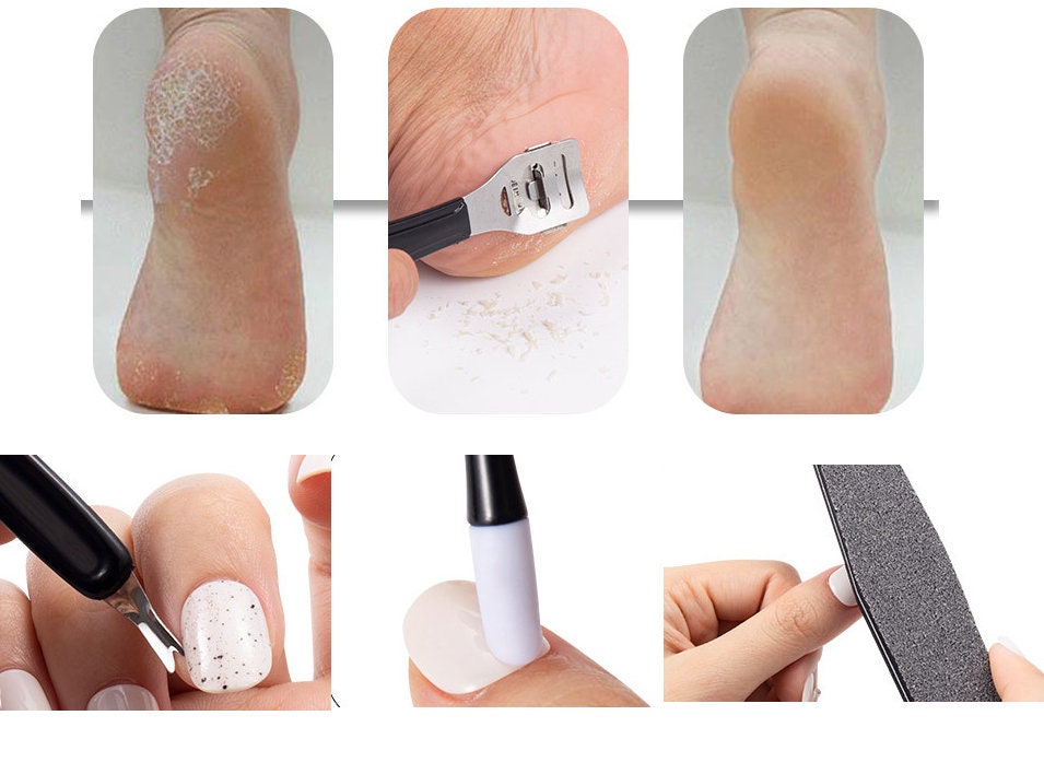 12pcs Pedicure Tools Set/ Foot Care Kit Feet Rasp Dead Skin Remover Kit/ Manicure File Buffer Kit Foot Callus Remove/ Nail supply Home care